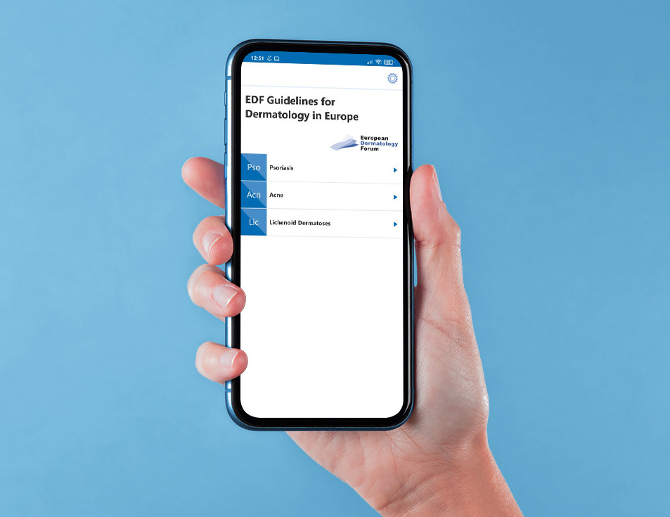 hold edf guidelines web